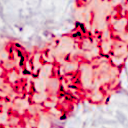 Hortensien Bicolor Weiß / Candy Pink